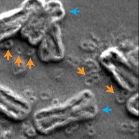 使用扫描电子显微镜，我们在癌细胞里看到了染色体DNA(蓝色箭头)和ecDNA(橙色箭头)(图片来源：Image courtesy of Paul Mischel, UC San Diego)